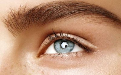 All You Need to Know About Eye Freckles