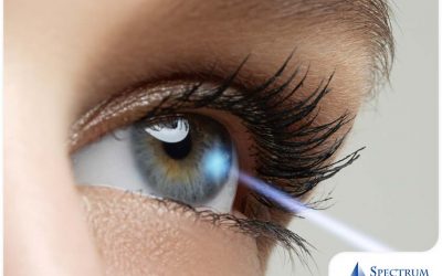 Myths About LASIK Exposed