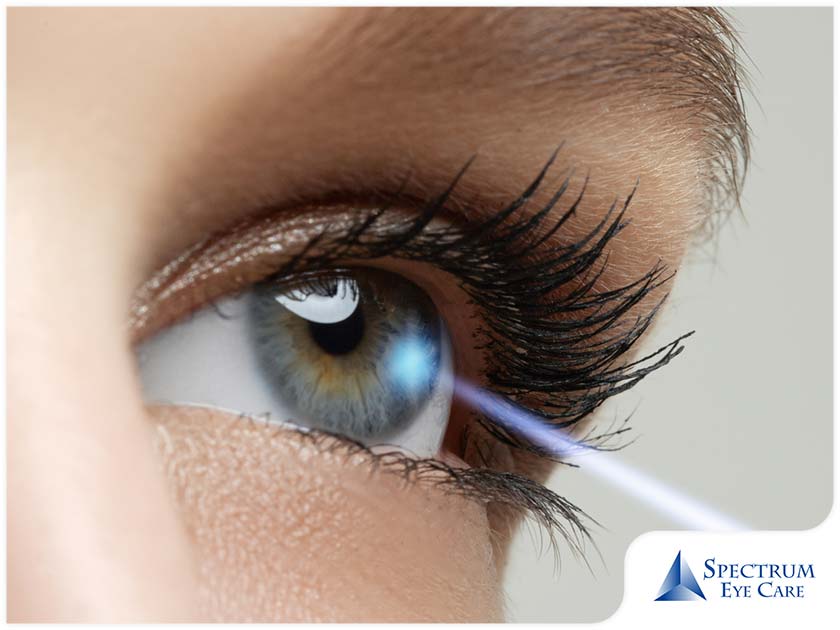 Myths About LASIK Exposed