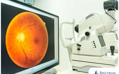 Eye Diseases That Can Be Caught Through Retinal Imaging