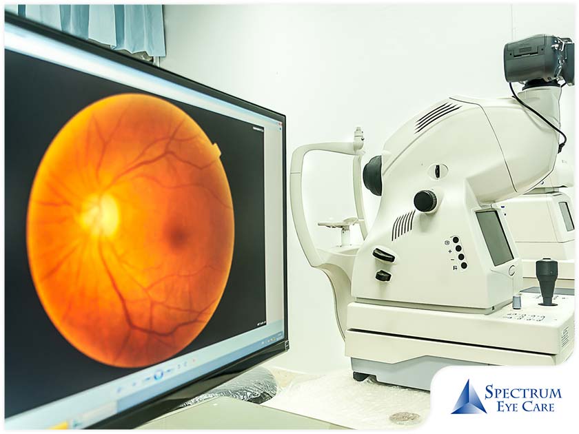 Eye Diseases That Can Be Caught Through Retinal Imaging