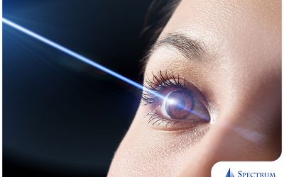 Essential Things to Know Before Getting Laser Eye Surgery