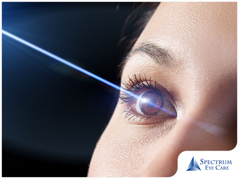 Essential Things to Know Before Getting Laser Eye Surgery
