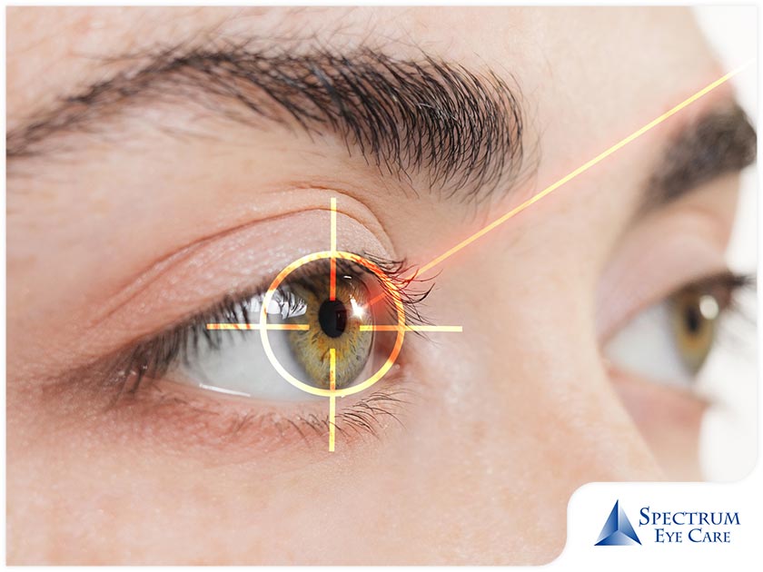 After a Laser Eye Surgery: What Are the Things to Expect?