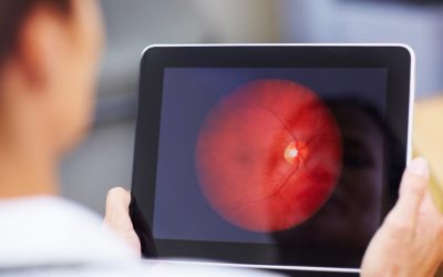The Importance of Retinal Imaging
